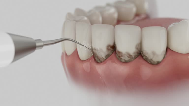 Reliable Dental Implants contractor in St. Stephen, SC by Smile Center Dentistry